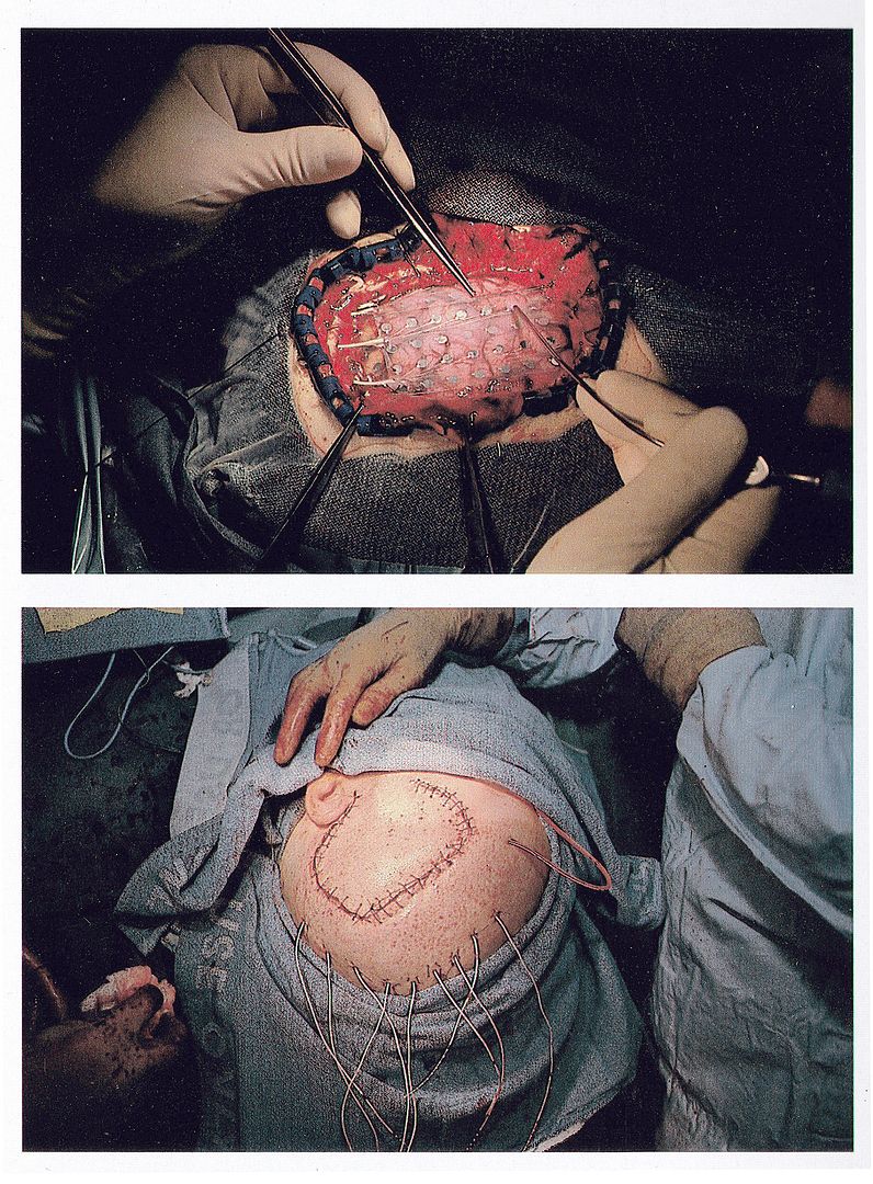  photo Brain-e-ack_zpserd9f2mc.jpg